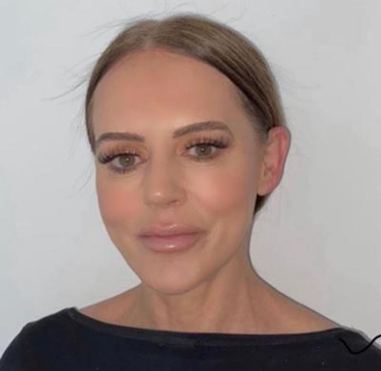 Jane Parry, Aesthetic Nurse Practitioner and Independent Nurse Prescriber